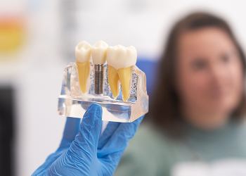 A dental implant model showing the post between two teeth