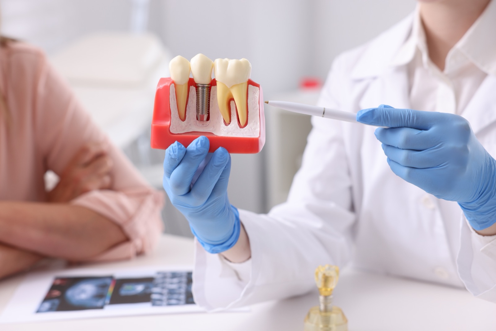 Model showing a dental implant supported by healthy bone